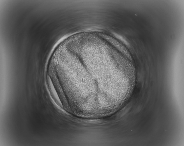 X0000086281471200704191935