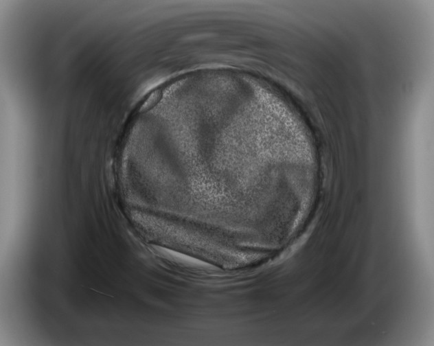 X0000086281497200704191935