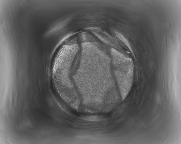 X0000086280059200704262044
