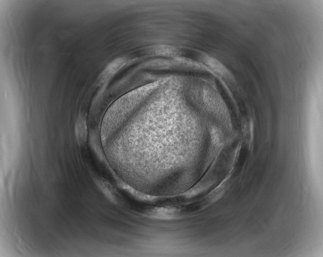 X0000086280158200704262043