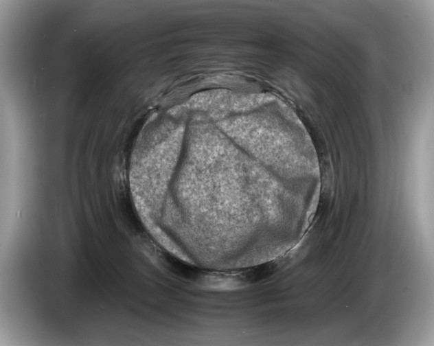 X0000086280179200704262043