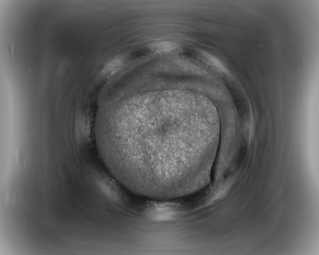 X0000086280268200704262042