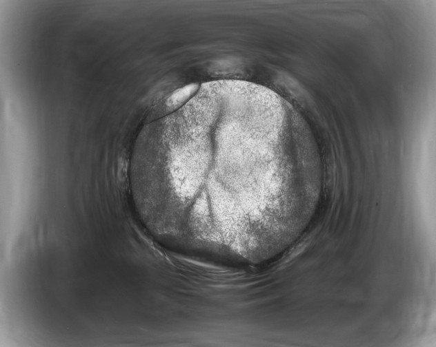 X0000086280281200704262042