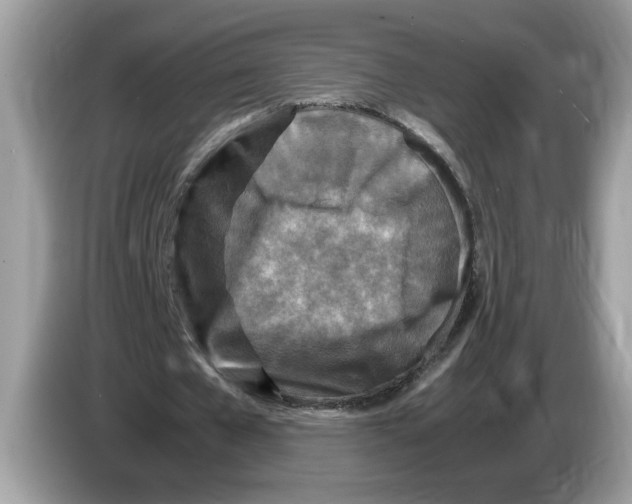 X0000086280577200704262038