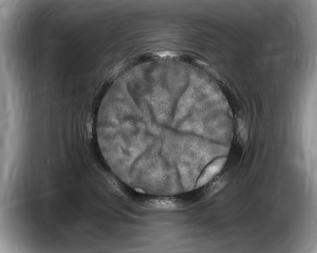 X0000086280668200704262037