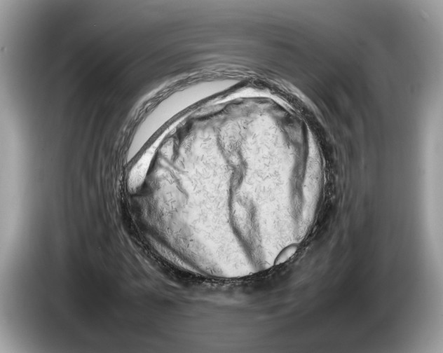 X0000086280775200704262035