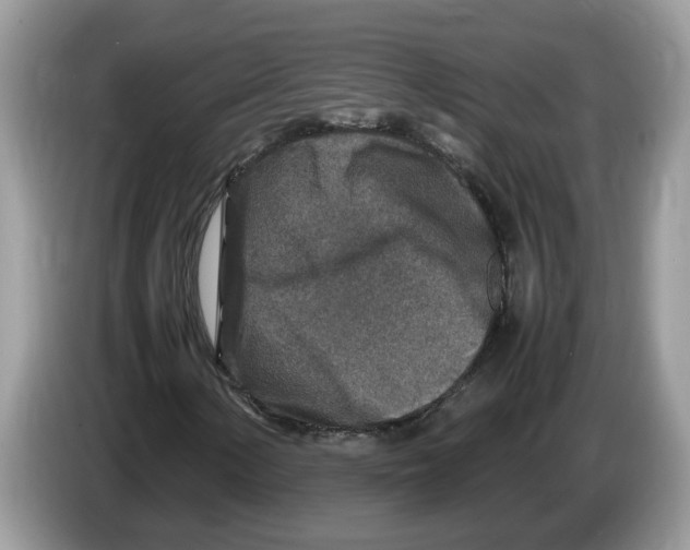 X0000086281154200704262030