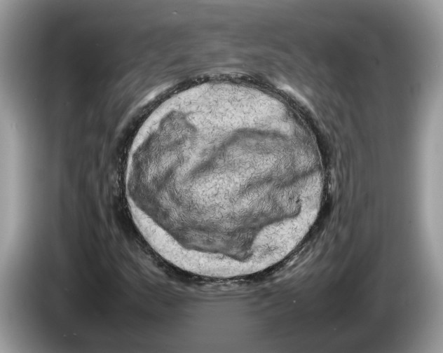 X0000086281159200704262030