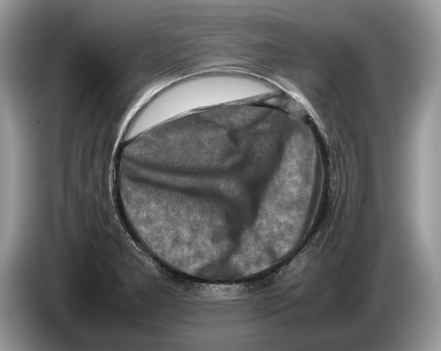 X0000086281277200704262029