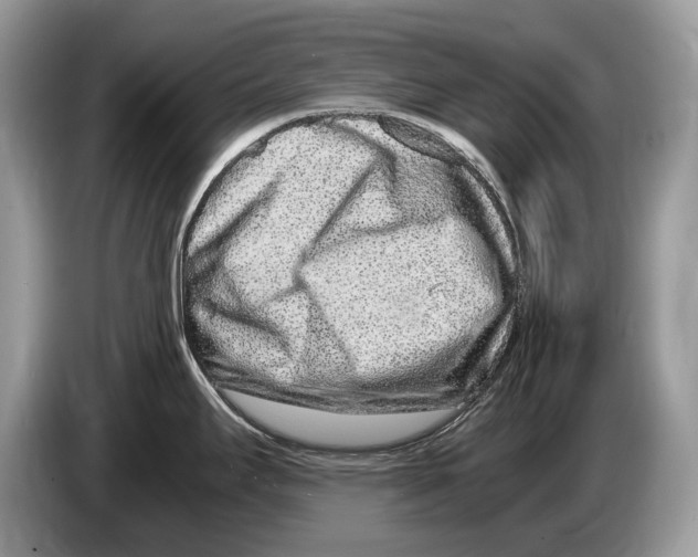 X0000086281295200704262029