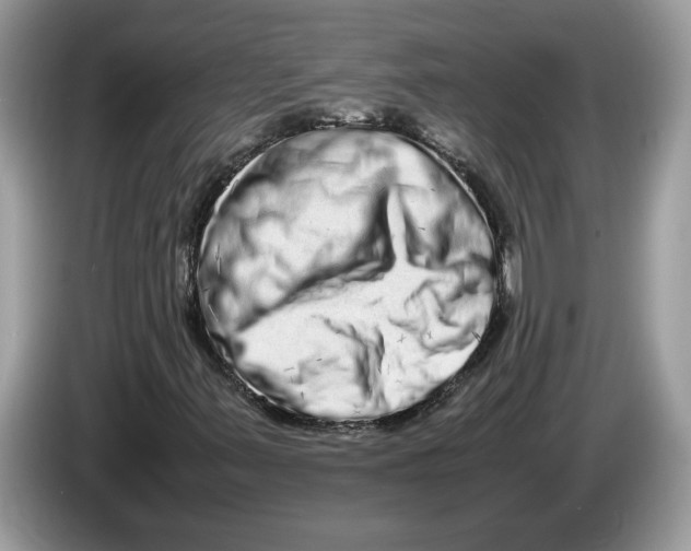 X0000086281347200704262028