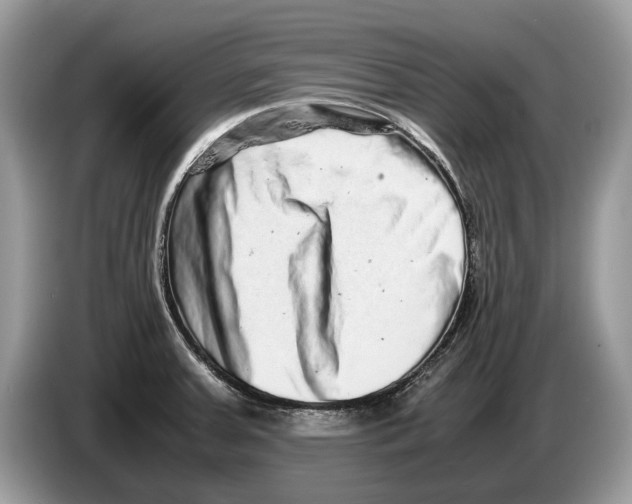 X0000086281379200704262028