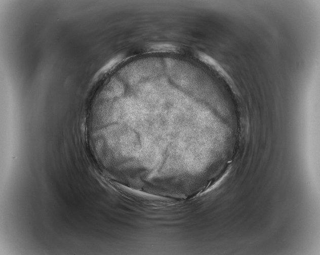 X0000086281403200704262027