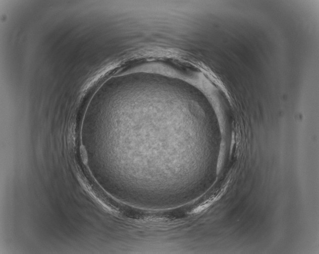 X0000086290581200703301138