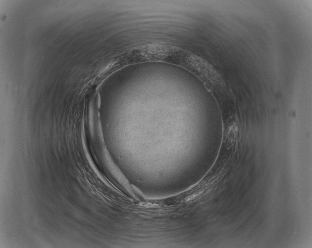 X0000086290772200703301135