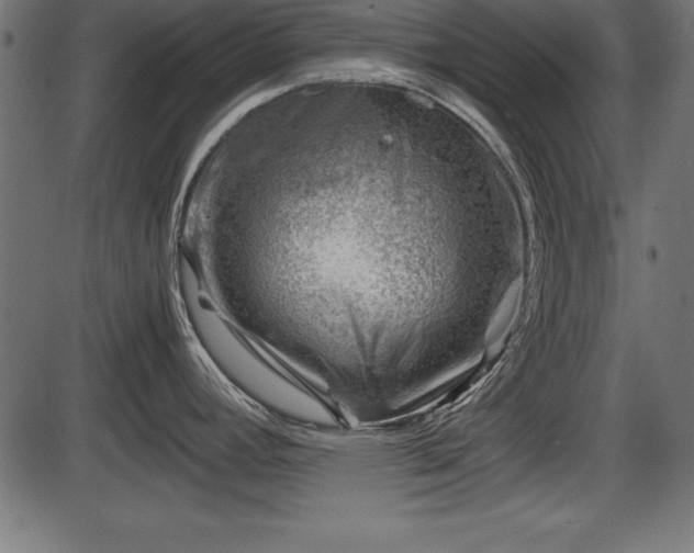 X0000086291392200704090944