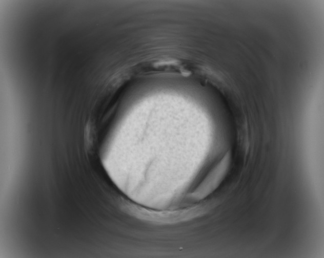 X0000086290038200704201931