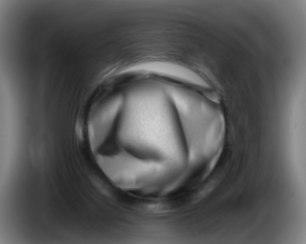 X0000086290068200704201931