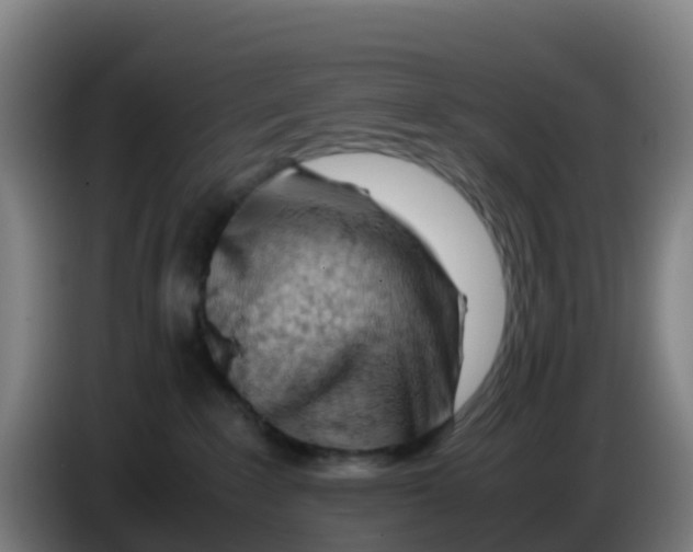 X0000086290235200704201929