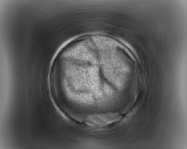 X0000086290959200704201920