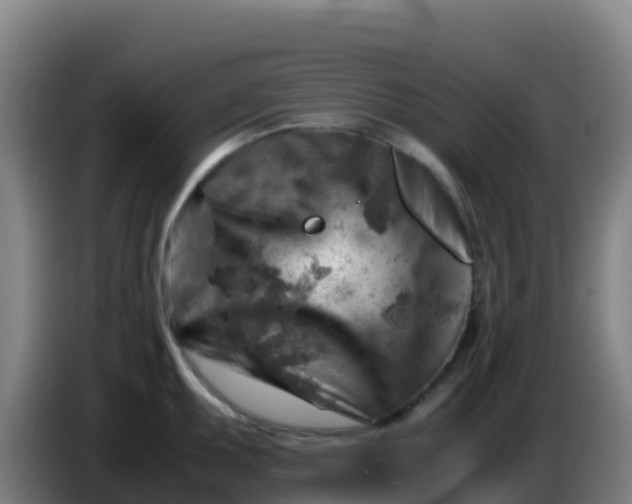 X0000086291095200704201918