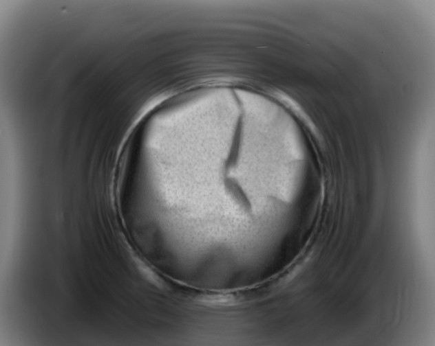 X0000086291186200704201917