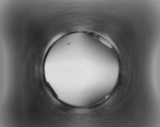 X0000086291285200704201916