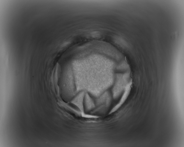 X0000086291297200704201915