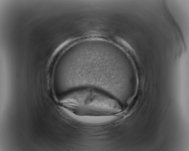 X0000086291310200704201915