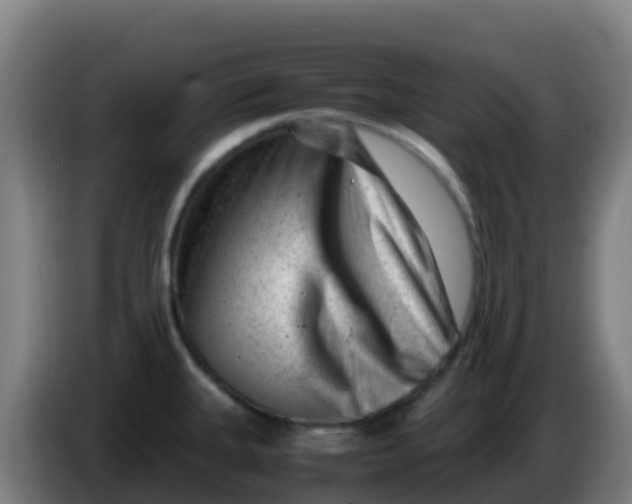 X0000086291335200704201915