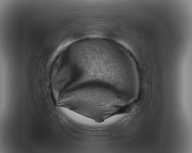 X0000086291359200704201915