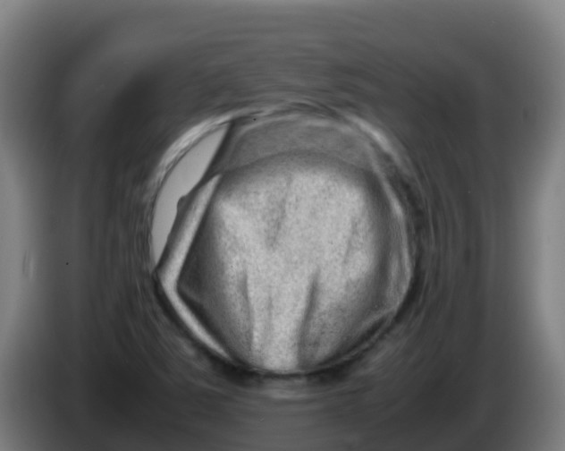 X0000086291363200704201915