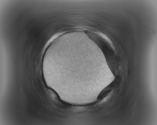 X0000086291373200704201915