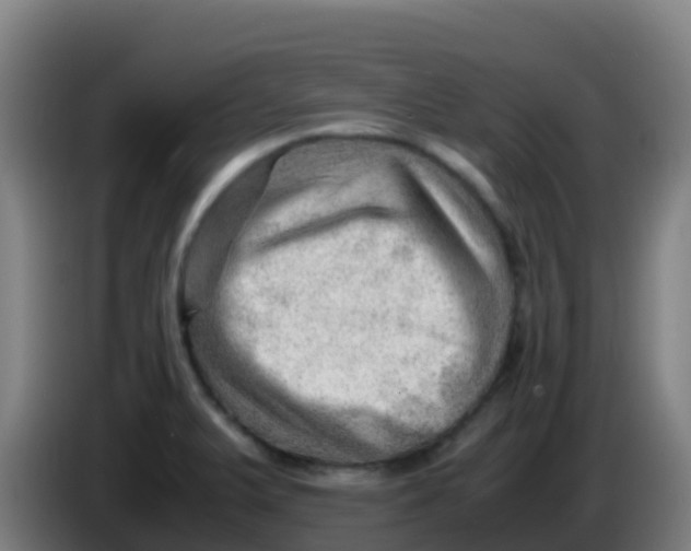 X0000086291375200704201914