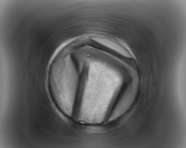 X0000086291379200704201914