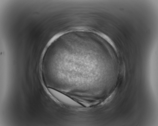 X0000086291381200704201914