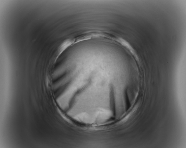 X0000086291385200704201914