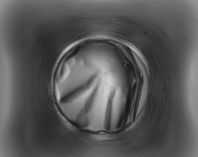 X0000086291388200704201914
