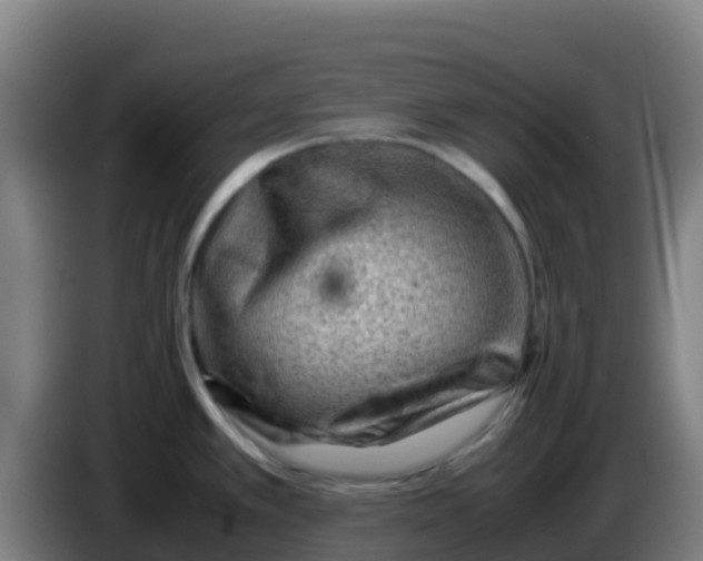 X0000086291389200704201914