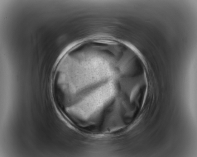X0000086291390200704201914