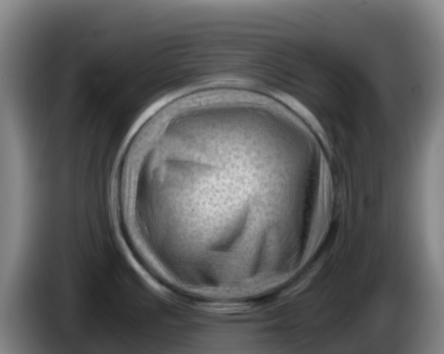 X0000086291391200704201914