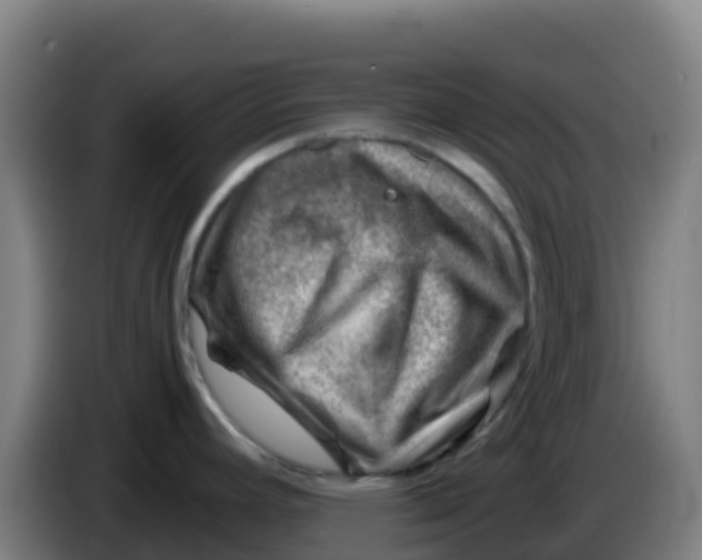X0000086291392200704201914