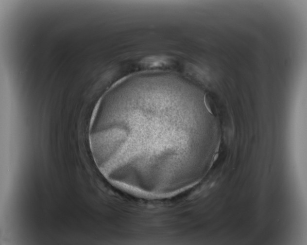 X0000086291393200704201914
