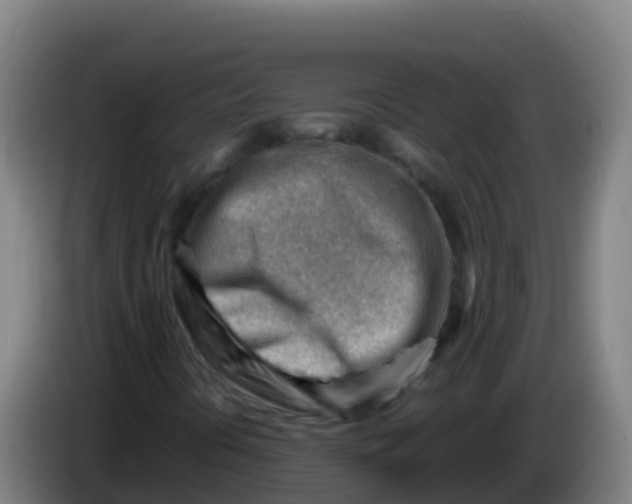 X0000086291394200704201914
