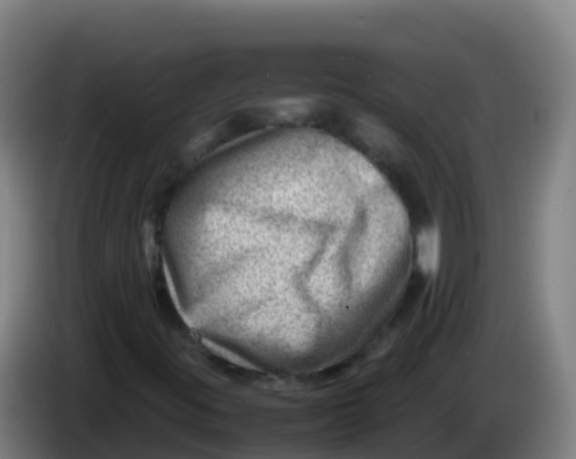 X0000086291395200704201914