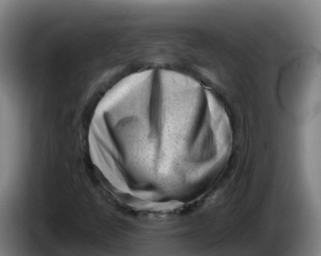 X0000086291398200704201914