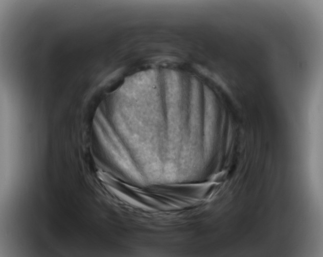 X0000086291399200704201914