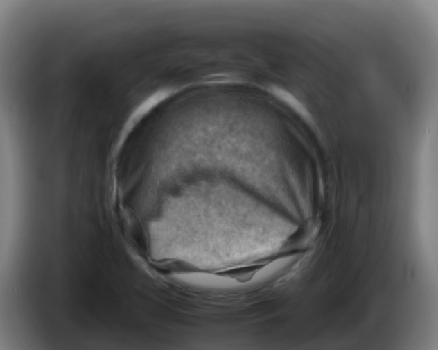 X0000086291413200704201914