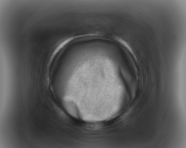 X0000086291415200704201914