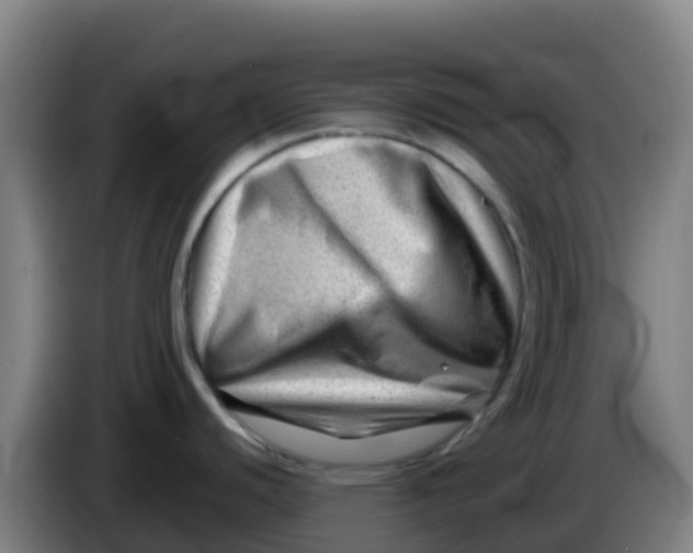 X0000086291440200704201914